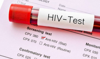 اطلاعیه- مشاوره و انجام تست سریع HIV  دوم دی ماه 99