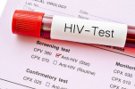 اطلاعیه- مشاوره و انجام تست سریع HIV  دوم دی ماه 99