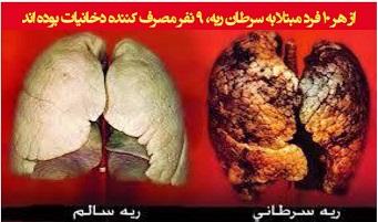 مصرف دخانیات عامل اصلی ابتلا به سرطان ریه